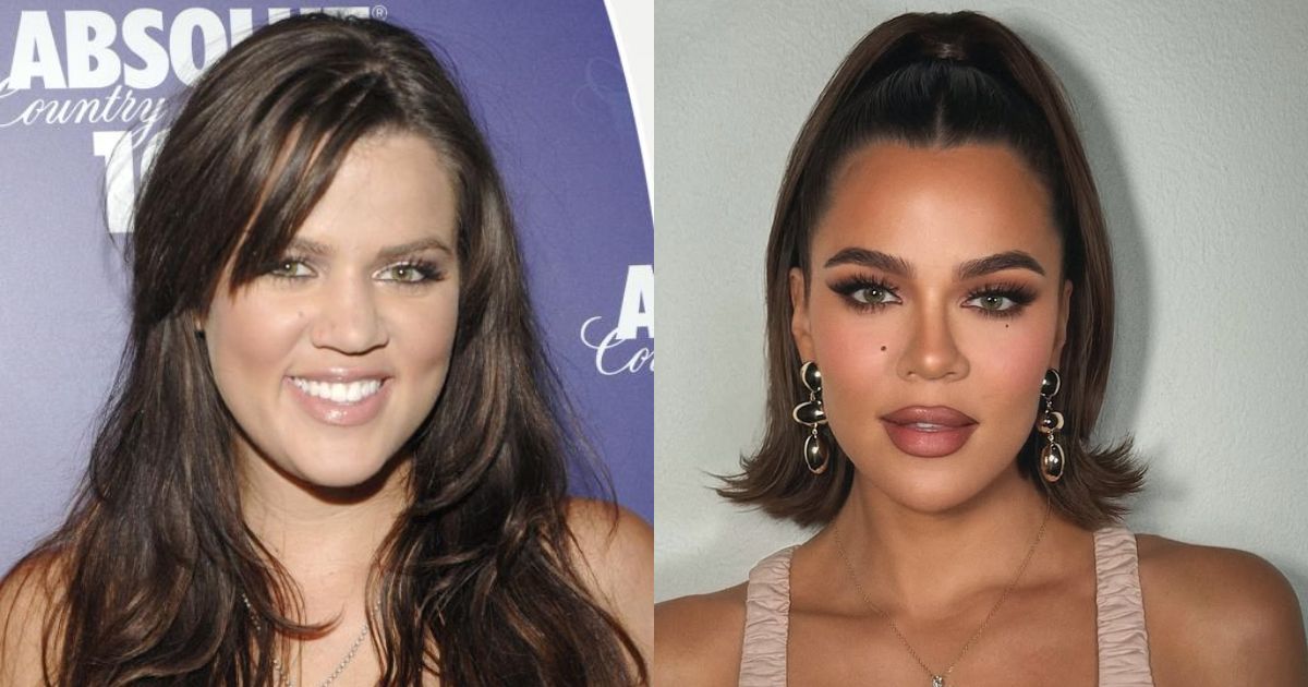 Khloé Kardashian Finally Opens Up About Every Cosmetic Procedure She’s