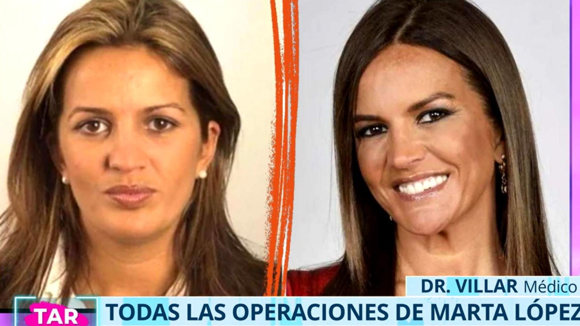 La increíble evolución estética de Marta López, antes y después de sus operaciones: "También me cuido..."