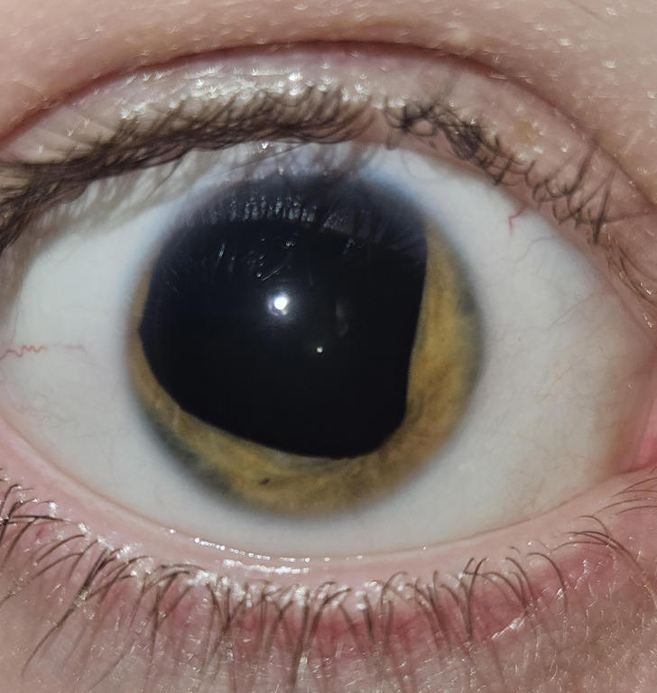 14 Unusual Features of the Human Body That Definitely Make Their Owners