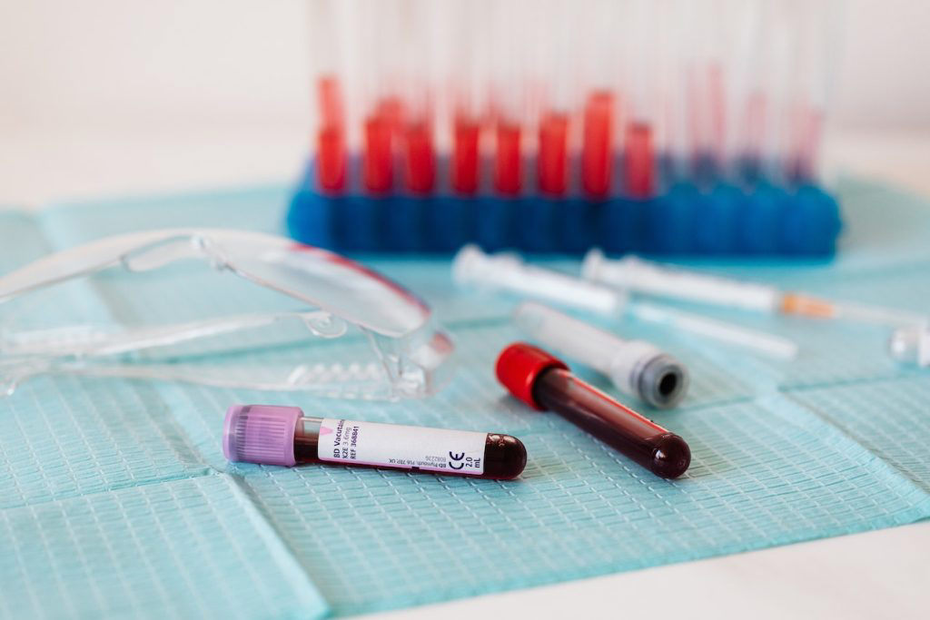 Study finds blood test can predict cognitive decline in dementia patients Study finds blood test can predict cognitive decline in dementia patients