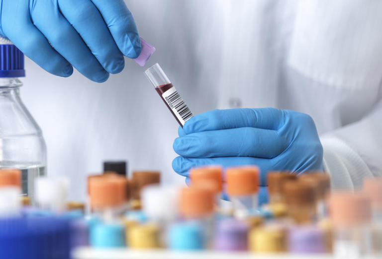 Scientists Discover New Blood Type, But There's a Catch