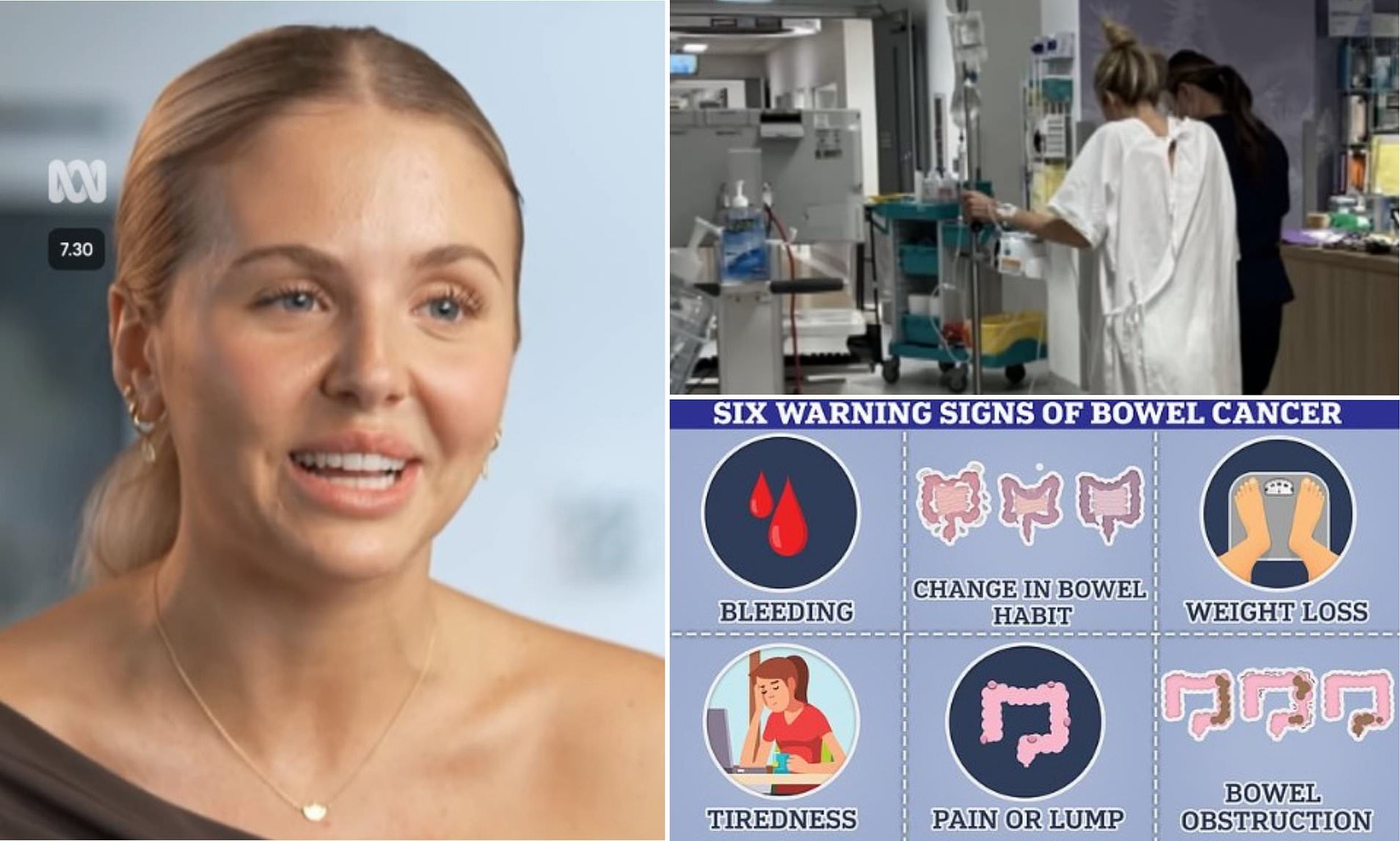 I was diagnosed with bowel cancer at 22 these are the subtle symptoms