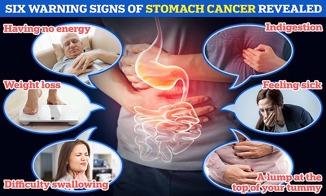 Doctors warn millions of people will be diagnosed with stomach cancer ...