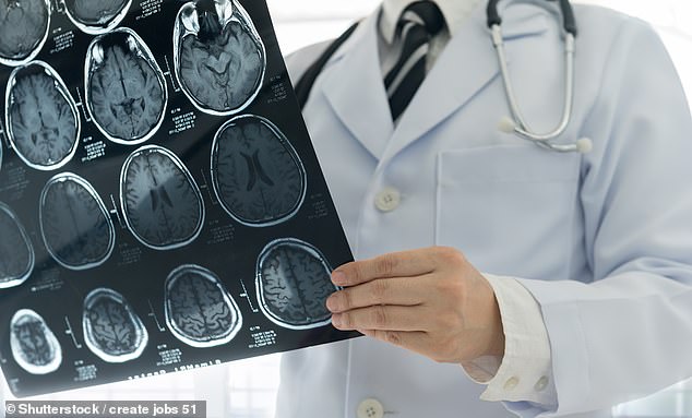 Chilling Find: Tiny Differences Reveal Psychopaths from the Rest