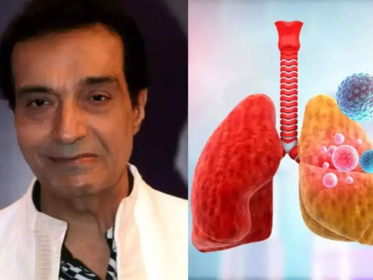 Dheeraj Kumar death: Know causes, symptoms & risks of acute pneumonia