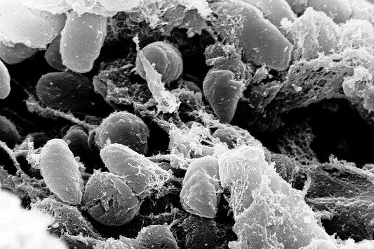 A person in the US has died from the plague Here s what you should know
