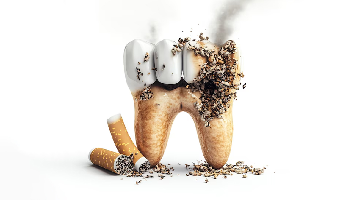 How To Remove Smoking Stains From Teeth? Dentist Shares Tips