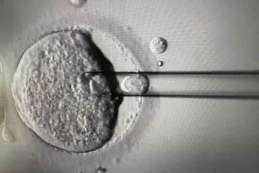 Four boys and four girls, including one set of identical twins, have been delivered and are all doing well (Newcastle Fertility Centre/PA)