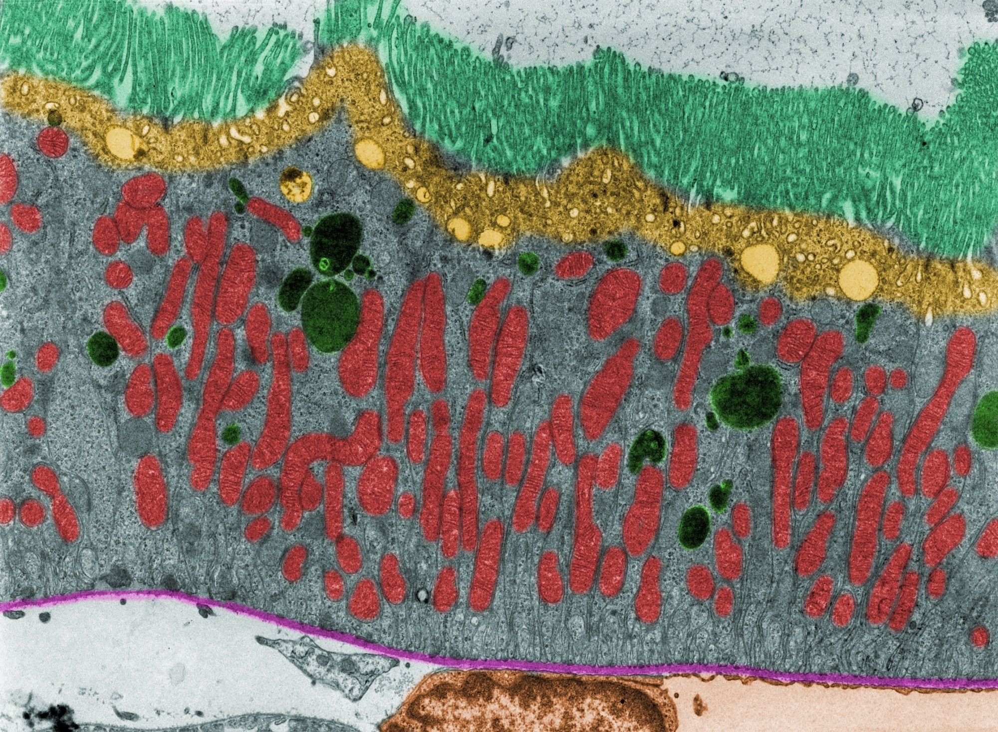 What Is Spatial Transcriptomics?