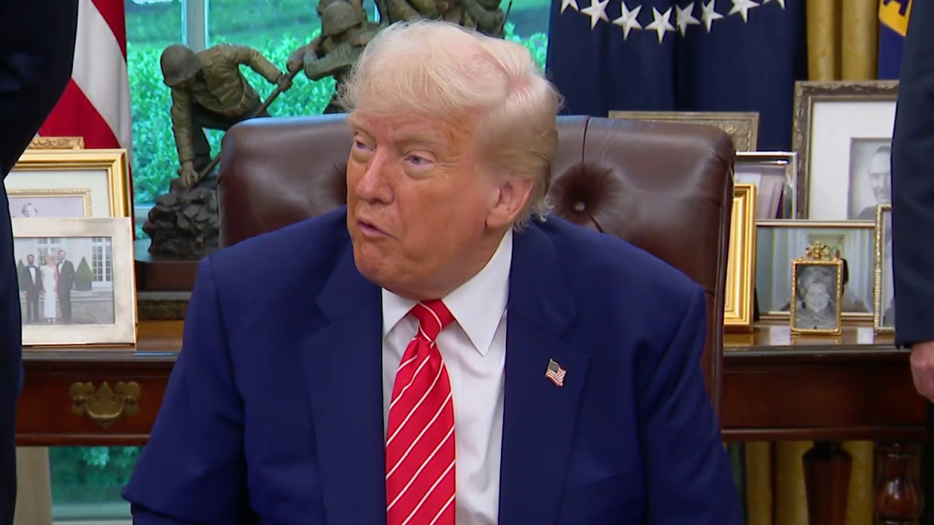 Common symptoms and causes of Trump's chronic venous insufficiency