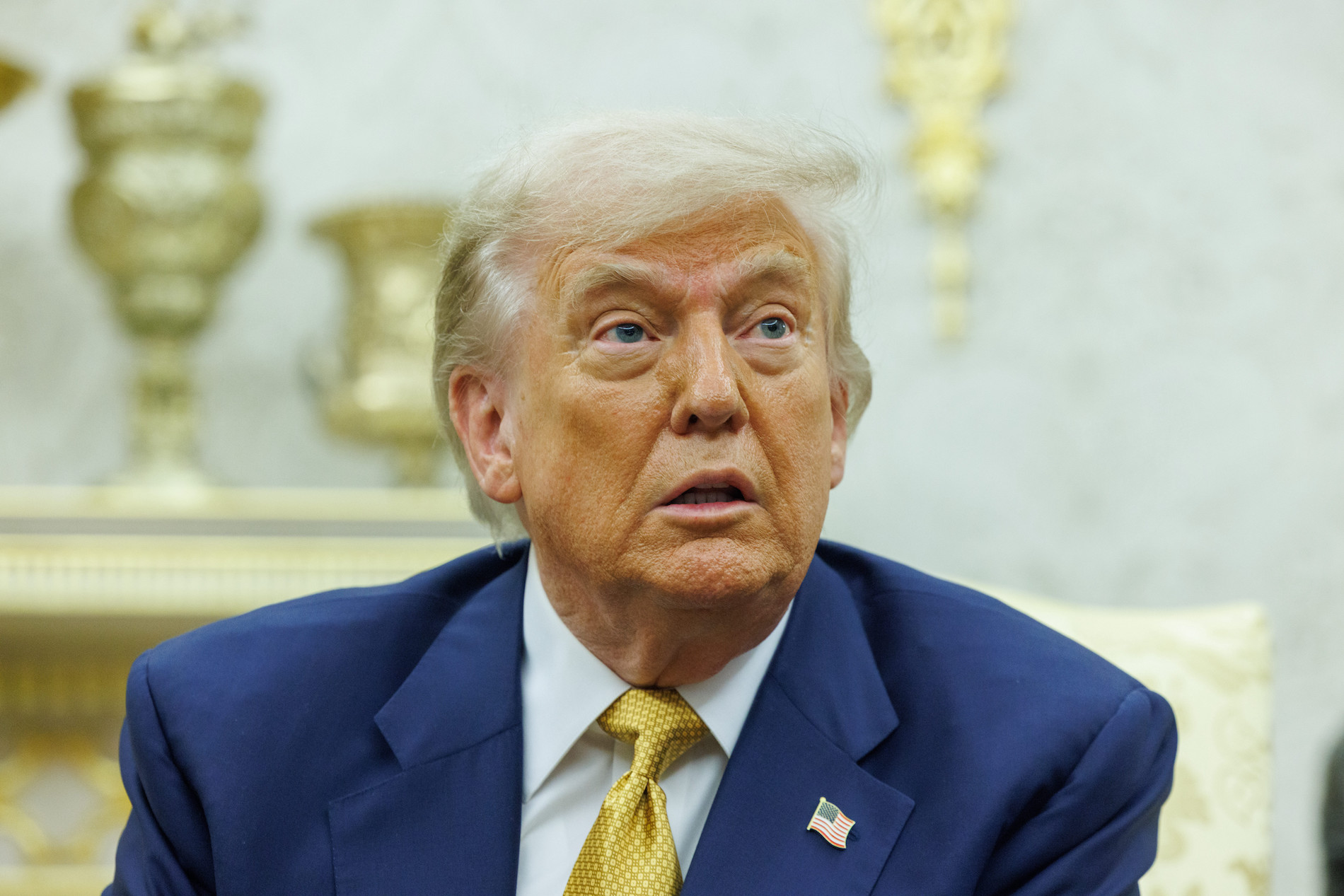DONALD TRUMP SOUFFRE D UNE INSUFFISANCE VEINEUSE UNE AFFECTION visual data 8