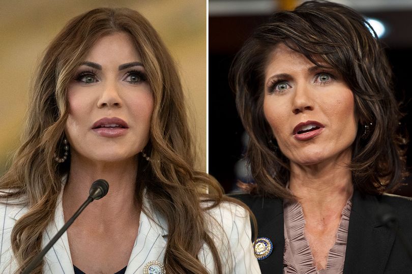 Kristi Noem's original face before plastic surgery seen in