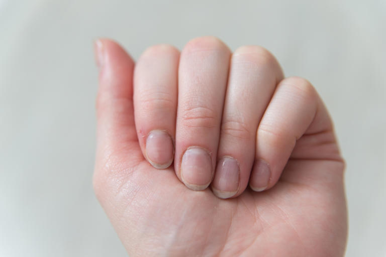 Changes in your nails may reveal information about your health