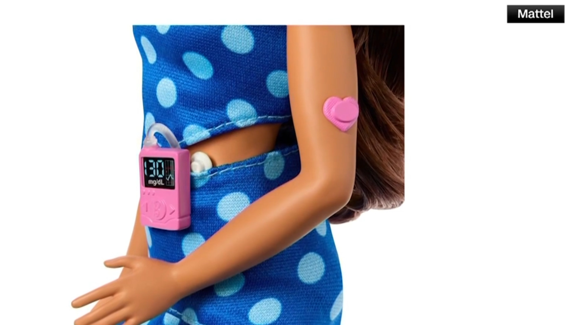 Mattel release barbie with type 1 diabetes