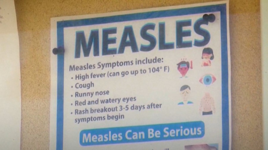 South Carolina sees first confirmed measles case of 2025