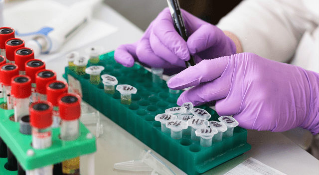 2 News Article Image Incyte slips after Q4 profit miss despite strong sales growth