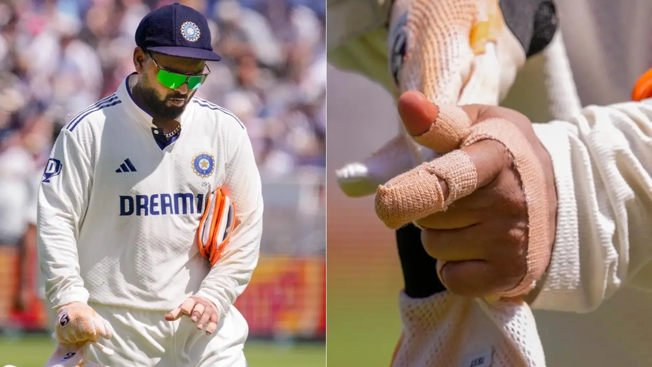 Nitish Kumar Reddy provides update on Rishabh Pant`s finger injury