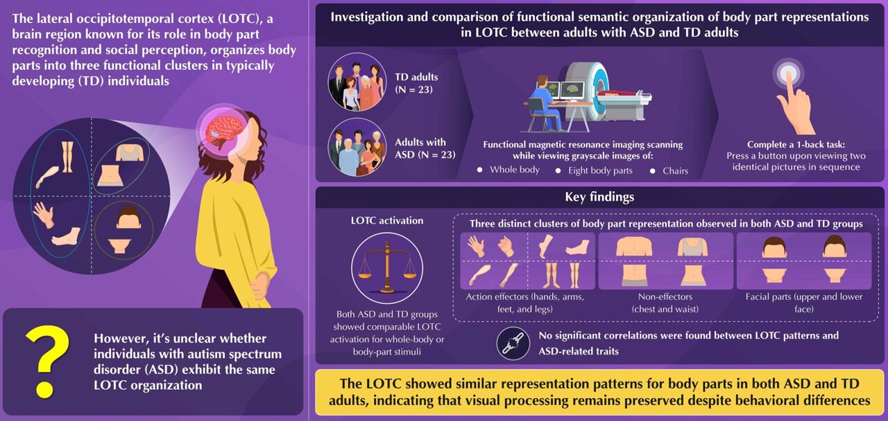Adults with autism show similar - AA1Iq911.img