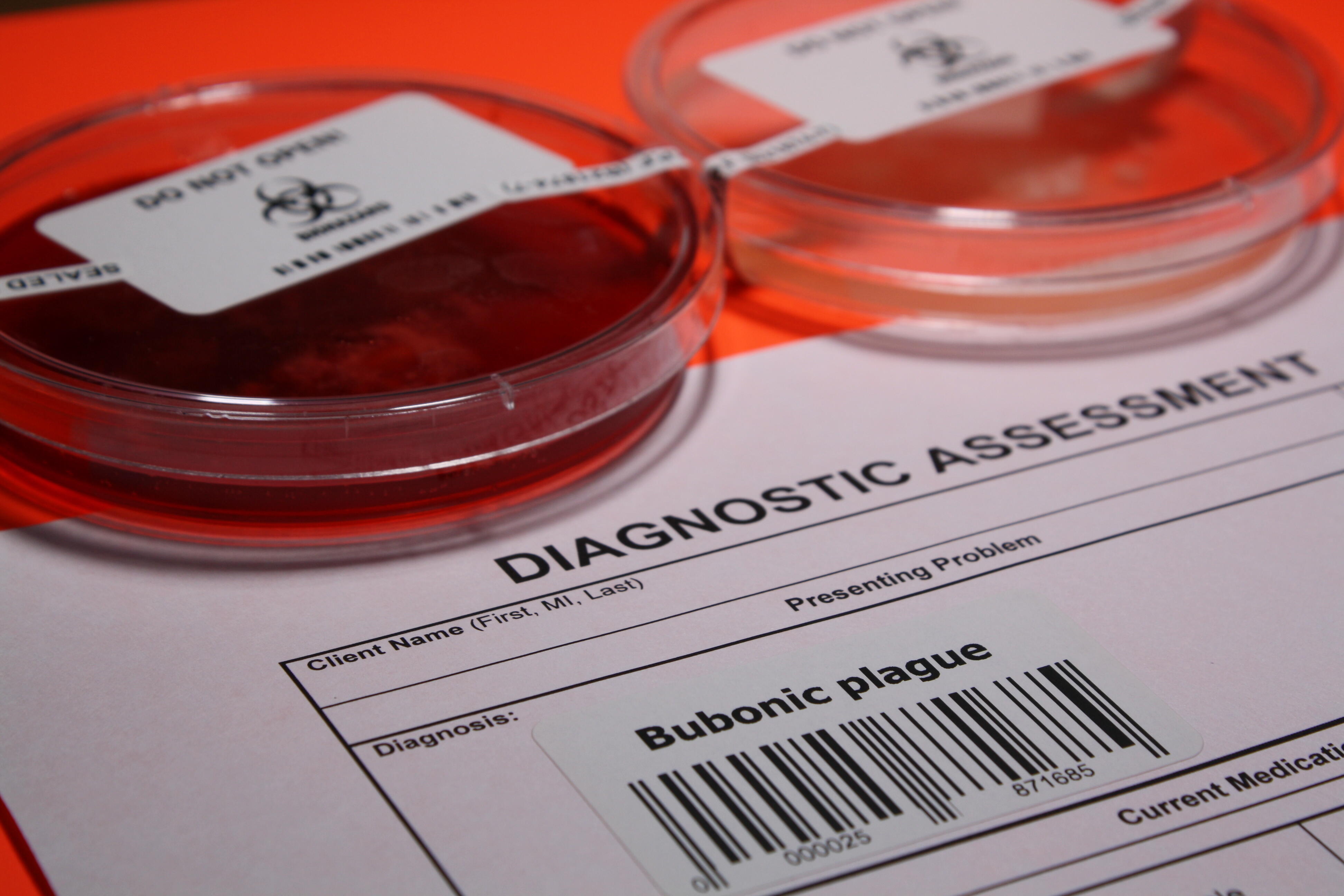 patient-dies-in-emergency-room-from-the-bubonic-plague