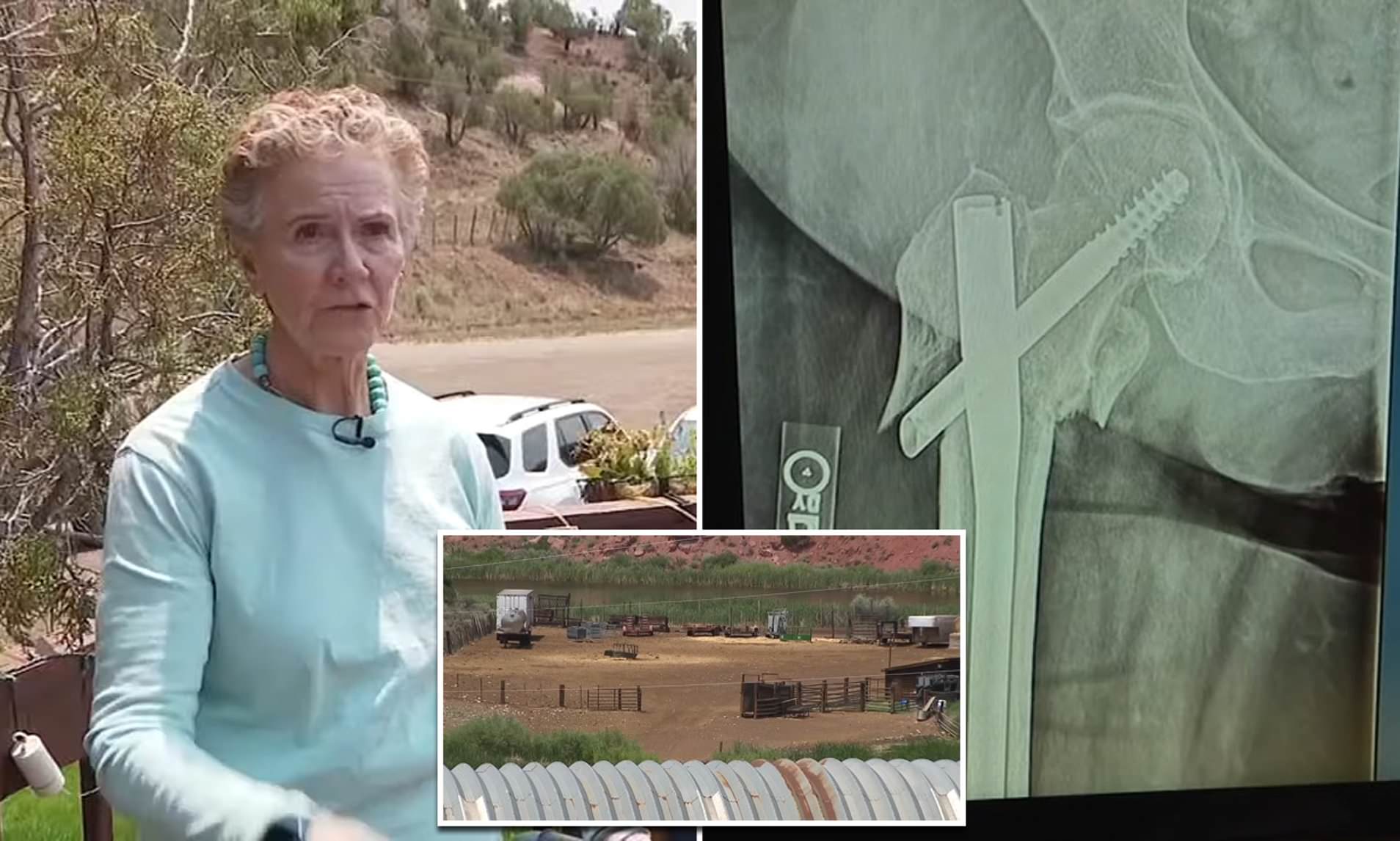 Colorado woman, 75, crawled across remote landscape for 14 hours with