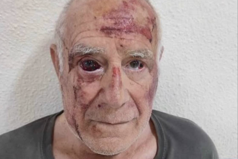 Espagne : émeutes anti-immigration après l’agression d’un vieil homme attribuée à des jeunes Maghrébins