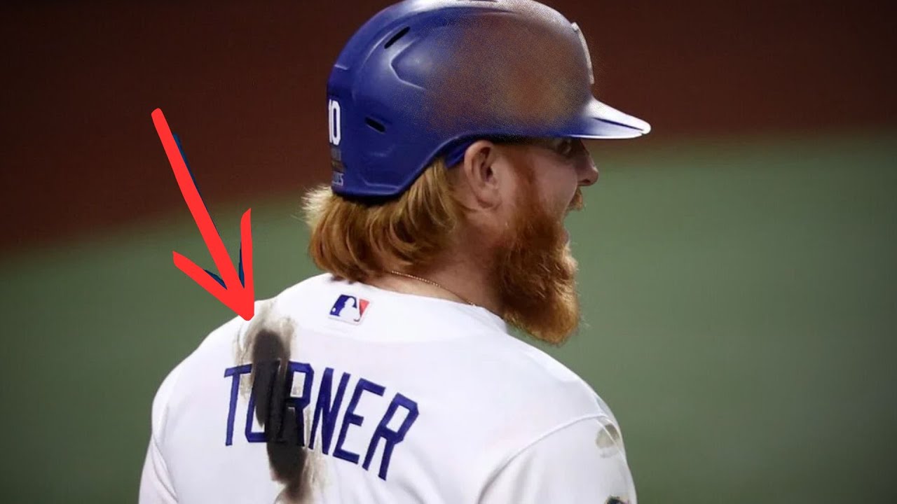 Why Baseball Players Are Obsessed With Sticky Stuff