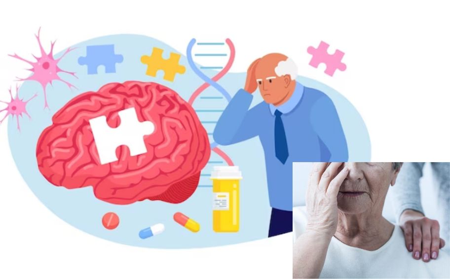 Phát hiện bốn nhóm triệu chứng có thể dẫn tới bệnh Alzheimer