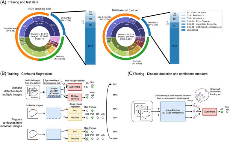 Q&A: Researchers discuss new insights on neurodegeneration from AI and ...