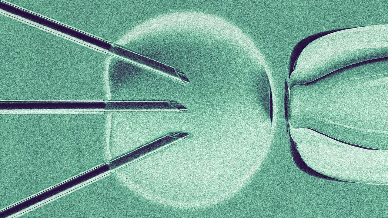 Babies born using 3 people's DNA lack hereditary disease