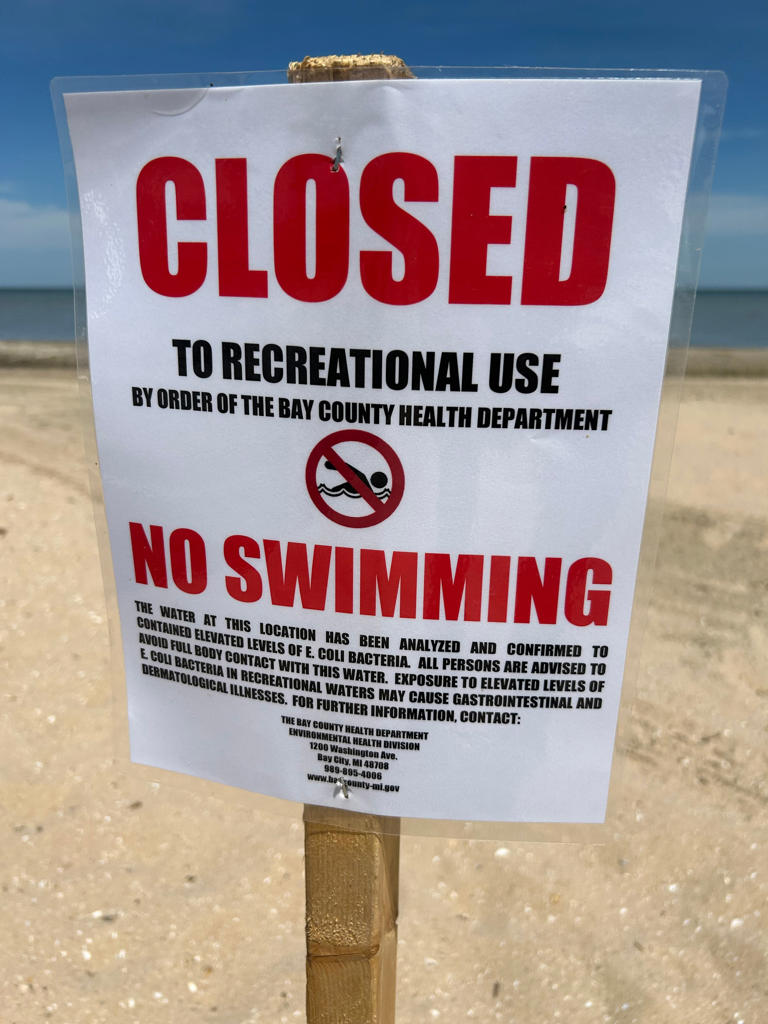 Some beaches closed or under bacterial contamination advisories during