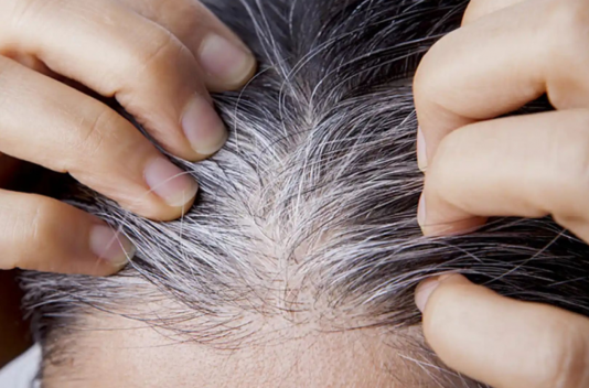 Adiós a las canas: la fórmula secreta que las elimina en menos de dos semanas y deja un cabello brillante, todo a un bajo costo