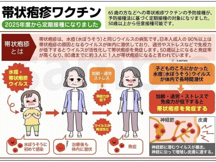 【医師が解説】2025年4月から65歳以上で定期接種になった帯状疱疹ワクチン。発症すると強い痛みが続き、深刻な後遺症に悩まされることもあります。ワクチンの種類や選び方、接種時の注意点など、大切な情報を分かりやすく解説します。