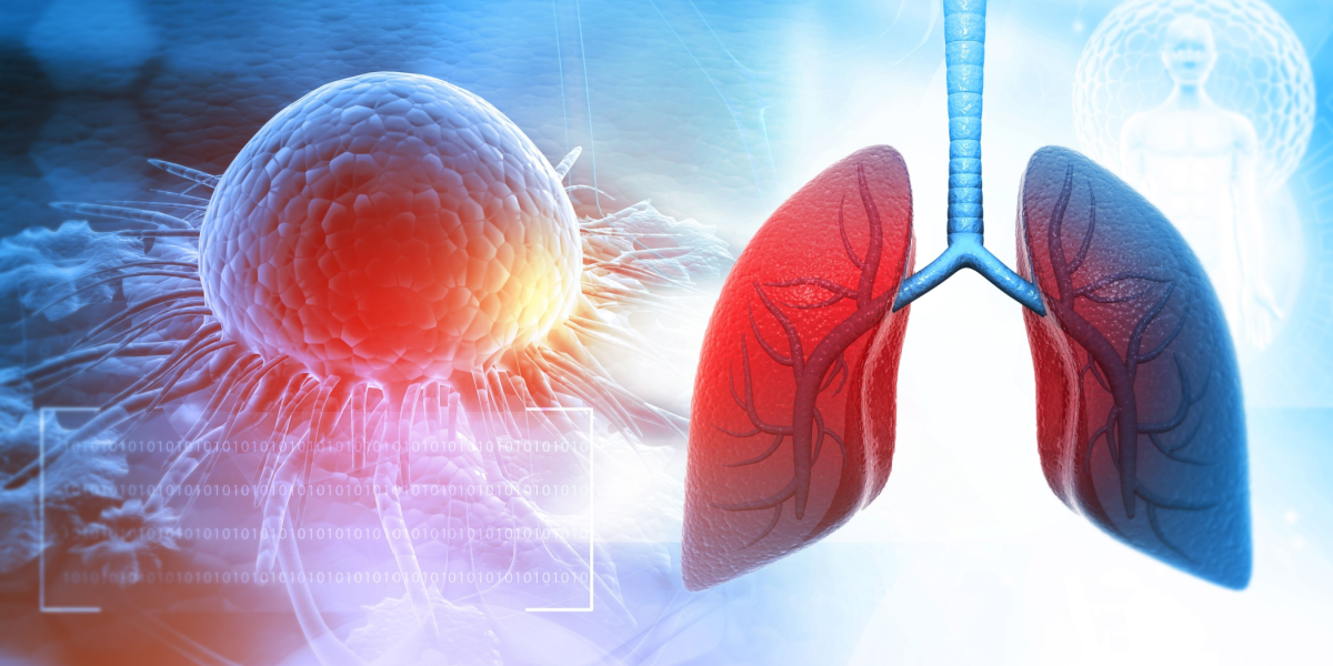 what-you-eat-might-increase-lung-cancer-risk