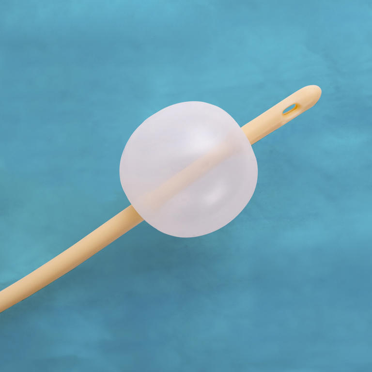 Can You Go Home With a Foley Bulb Induction? Essential Facts!