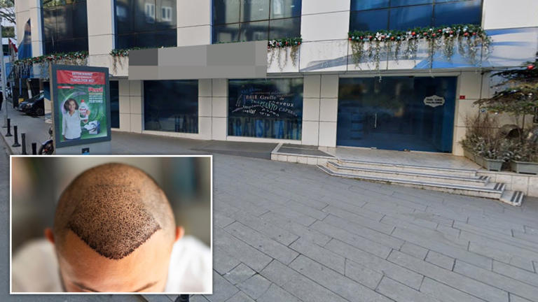 British tourist, 38, dies after Turkey hair transplant