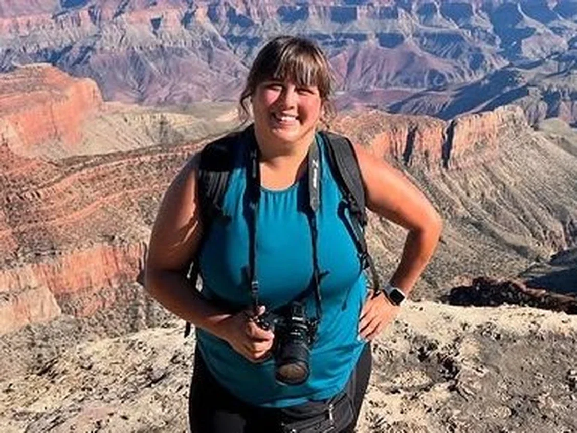 Woman faces more than 20,000 in medical bills after wild bat flies(02)