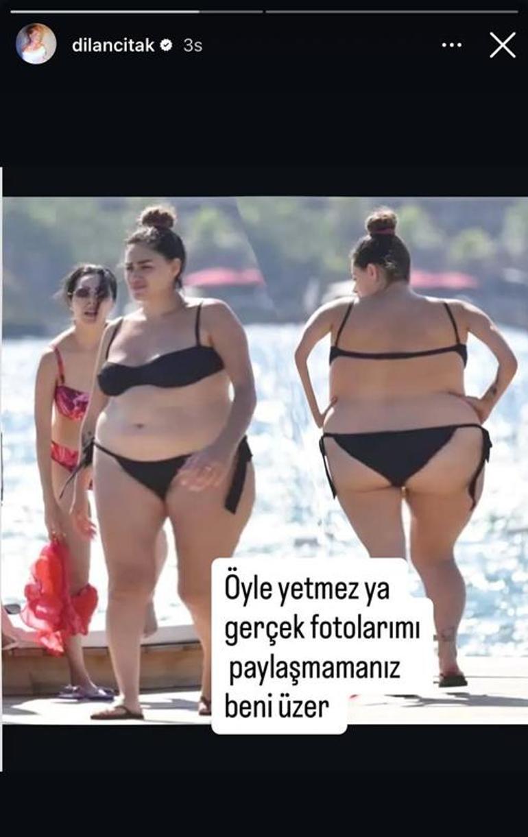 Olaylı Dilan Çıtak bu kez fotoğraflarına sinirlendi! 'Öyle yetmez...'