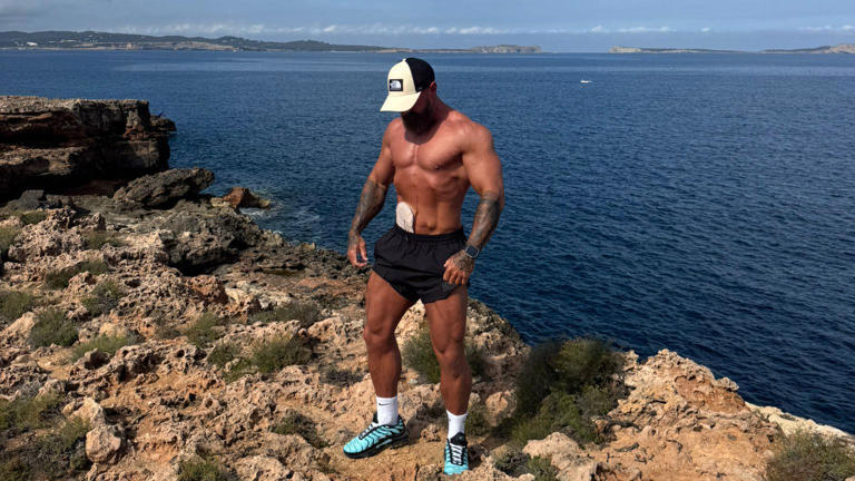 I'm a bodybuilder but bowel cancer in my 30s nearly killed me