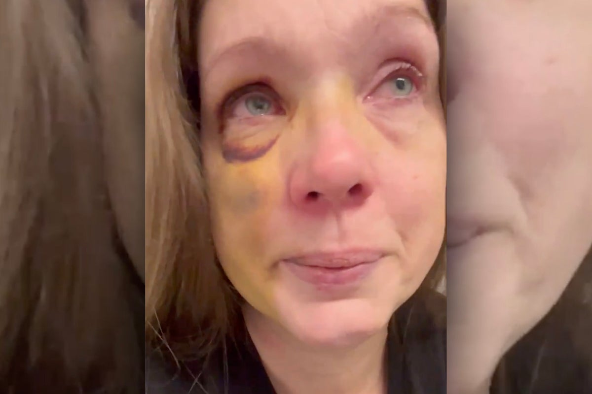 Mom knocked out in Cincinnati mob attack breaks silence after suffering