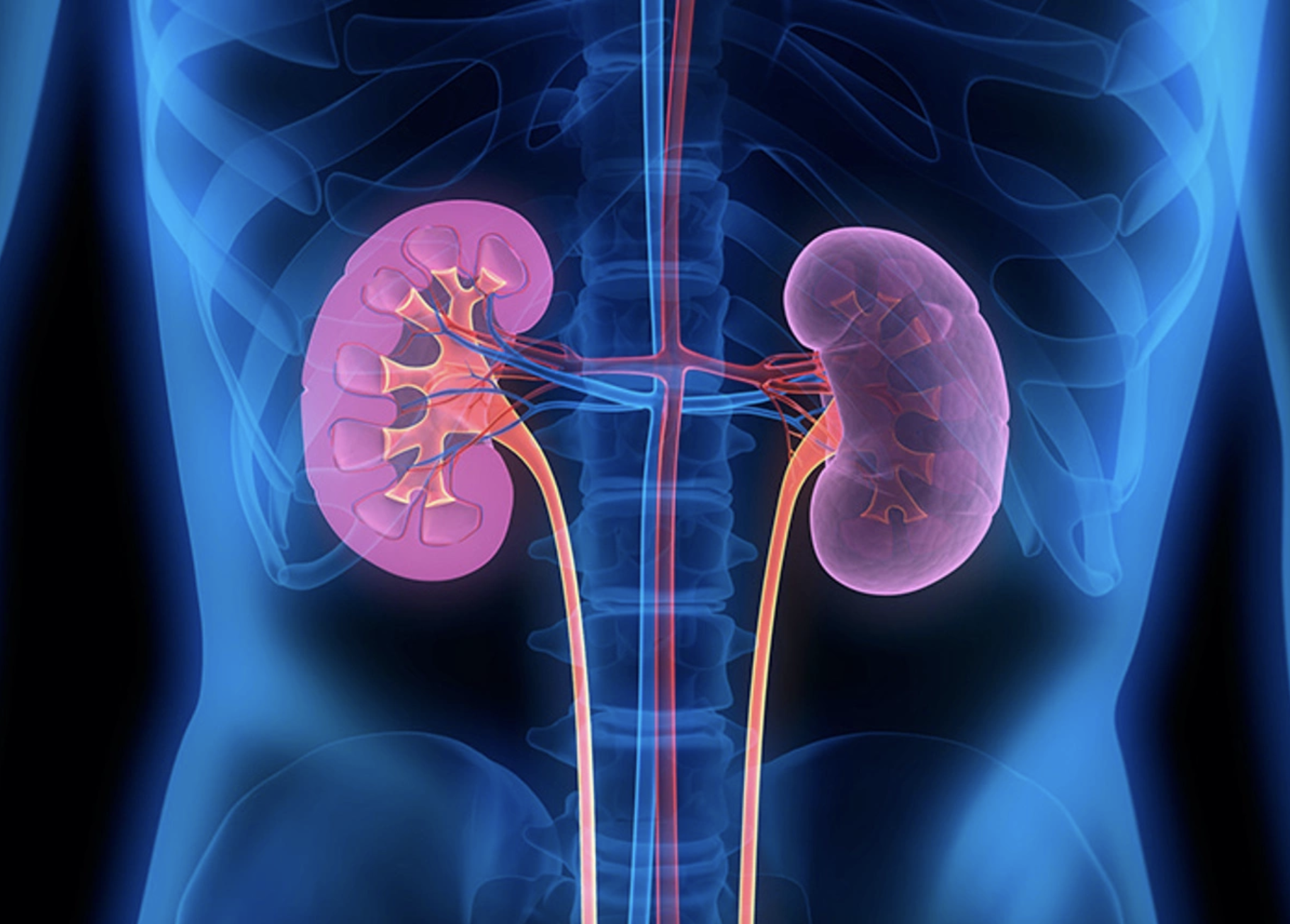 Dấu hiệu thận 'kêu cứu' dễ nhầm với bệnh khác