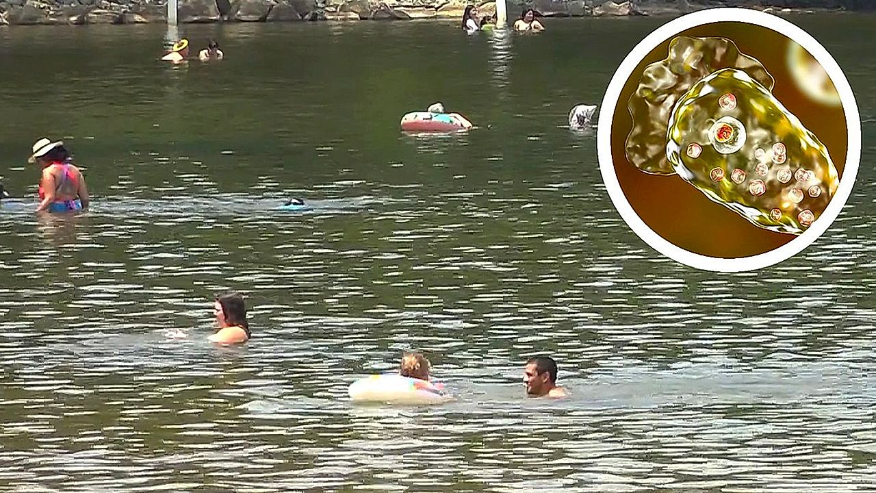 Child dies of braineating amoeba after swimming in South Carolina lake