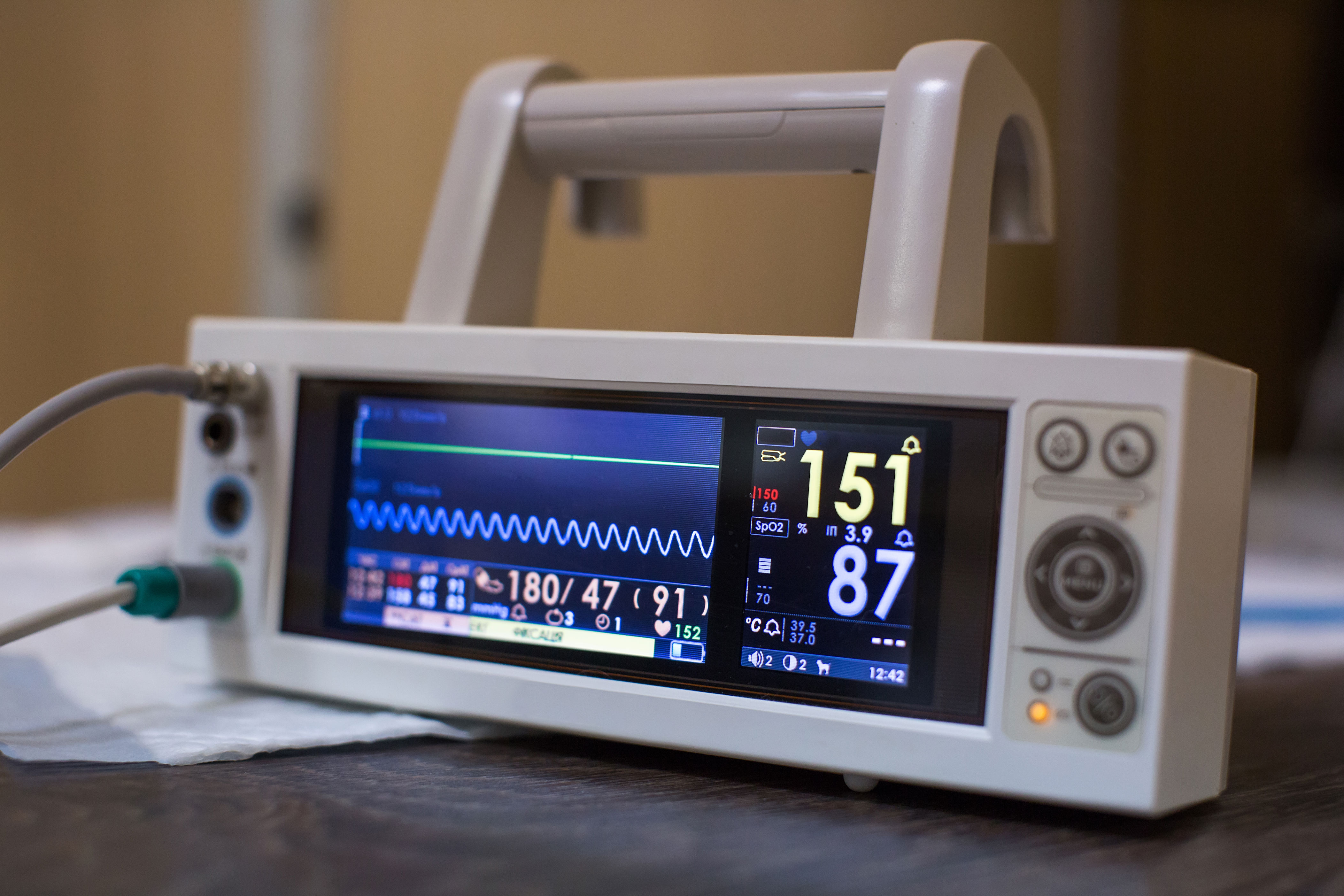 HRV Garmin: Unlock the Secrets of Your Autonomic Health with Heart Rate Variability Tracking