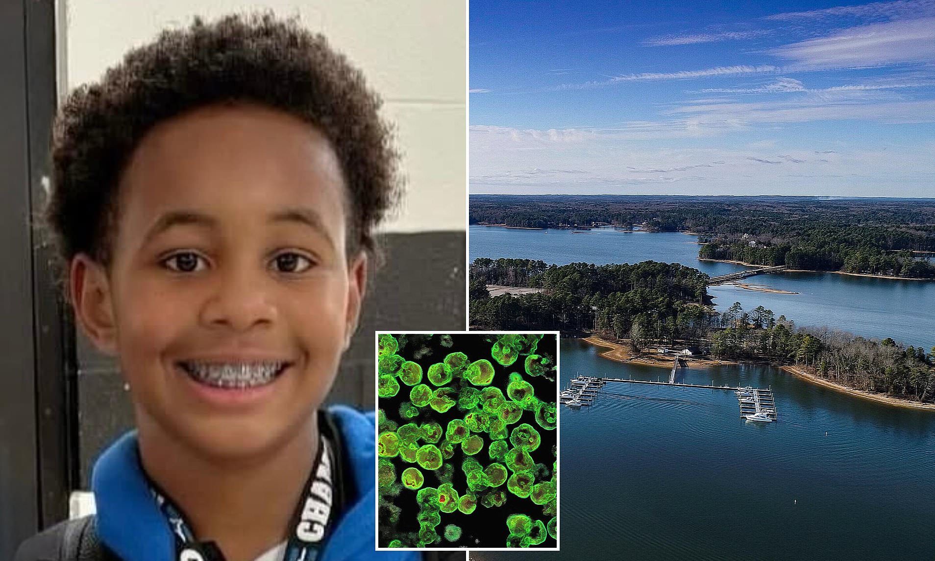 Family in shock after 12yearold dies from braineating amoeba after