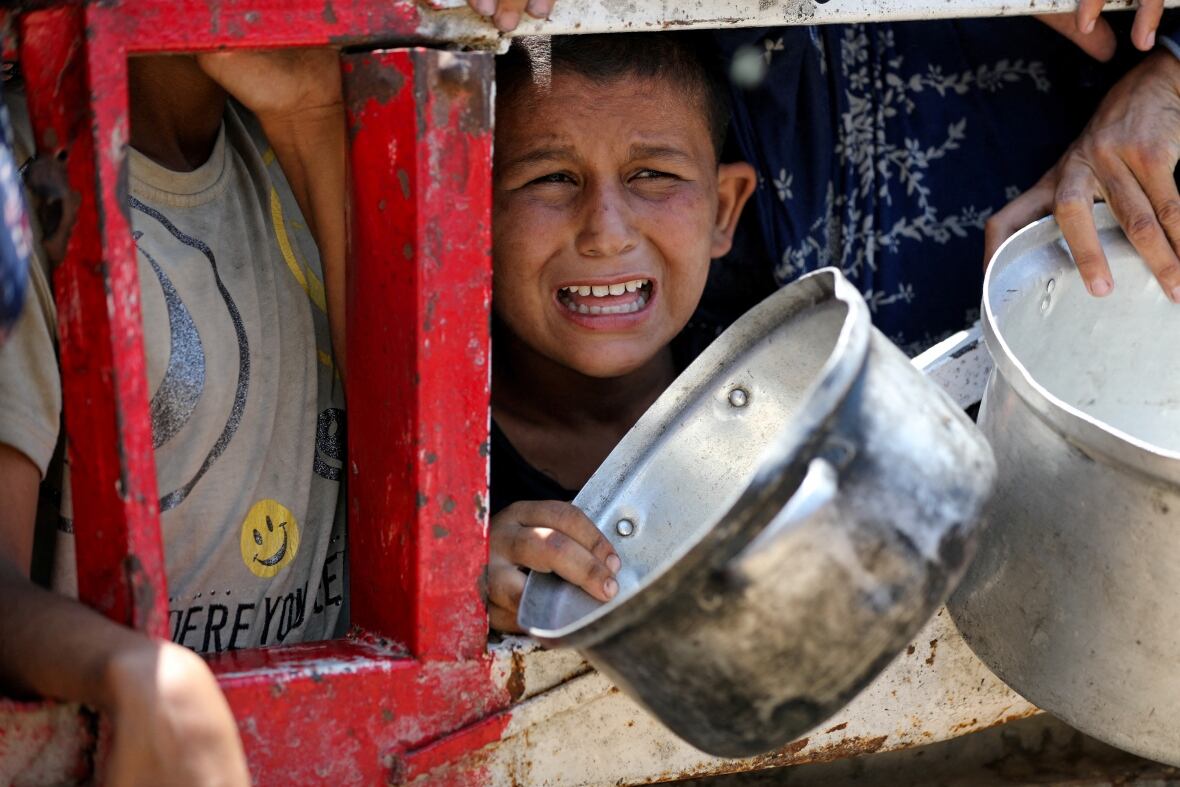 ‘We’re witnessing starvation as a weapon of war’ in Gaza: Canadian doctor