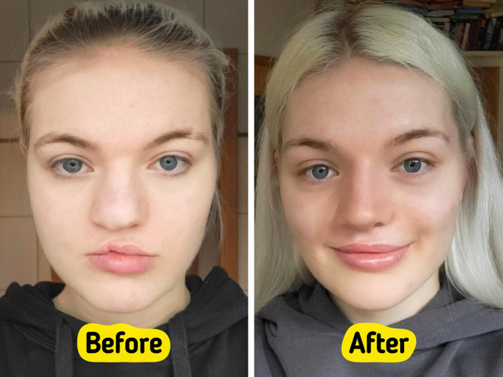 13 Before-and-After Photos That Tell a Whole Story