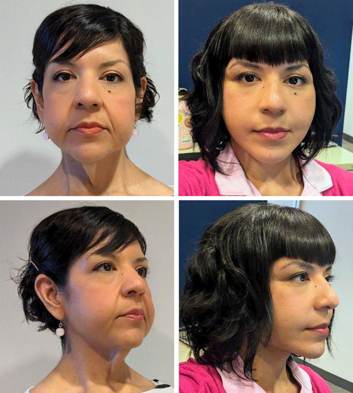 13 Before-and-After Photos That Tell a Whole Story