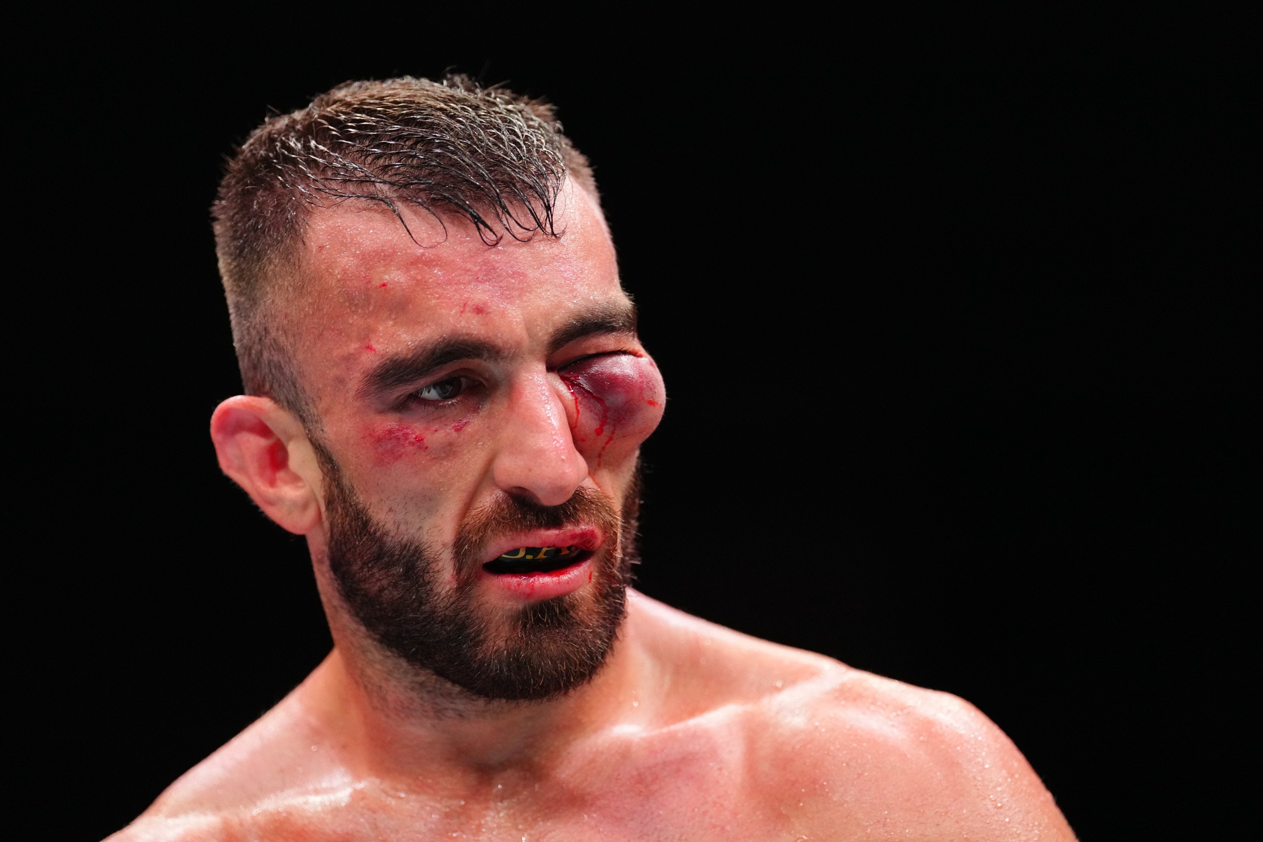 Referee S Reasoning For Not Stopping Nguyen Vs Yahya Earlier Seemed