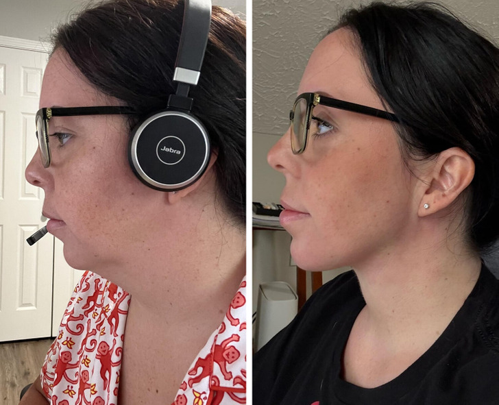 13 Before-and-After Photos That Tell a Whole Story