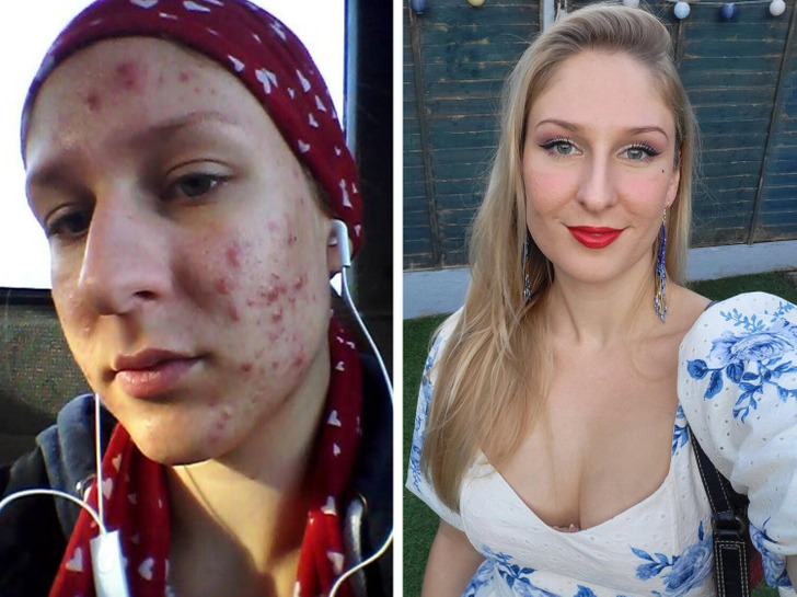 13 Before-and-After Photos That Tell a Whole Story