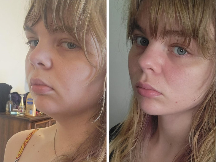 13 Before-and-After Photos That Tell a Whole Story